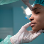 What to Know Before Getting the Best AlloClae in NYC