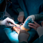 Complex Ankle Injuries in Houston Are Increasingly Treated With Advanced Surgical and Reconstructive Approaches